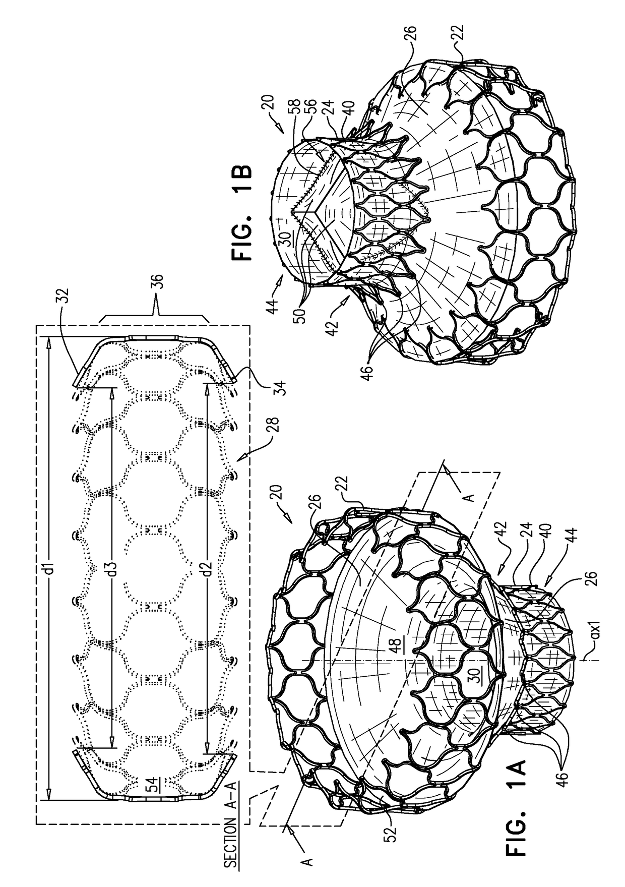 Articulatable prosthetic valve