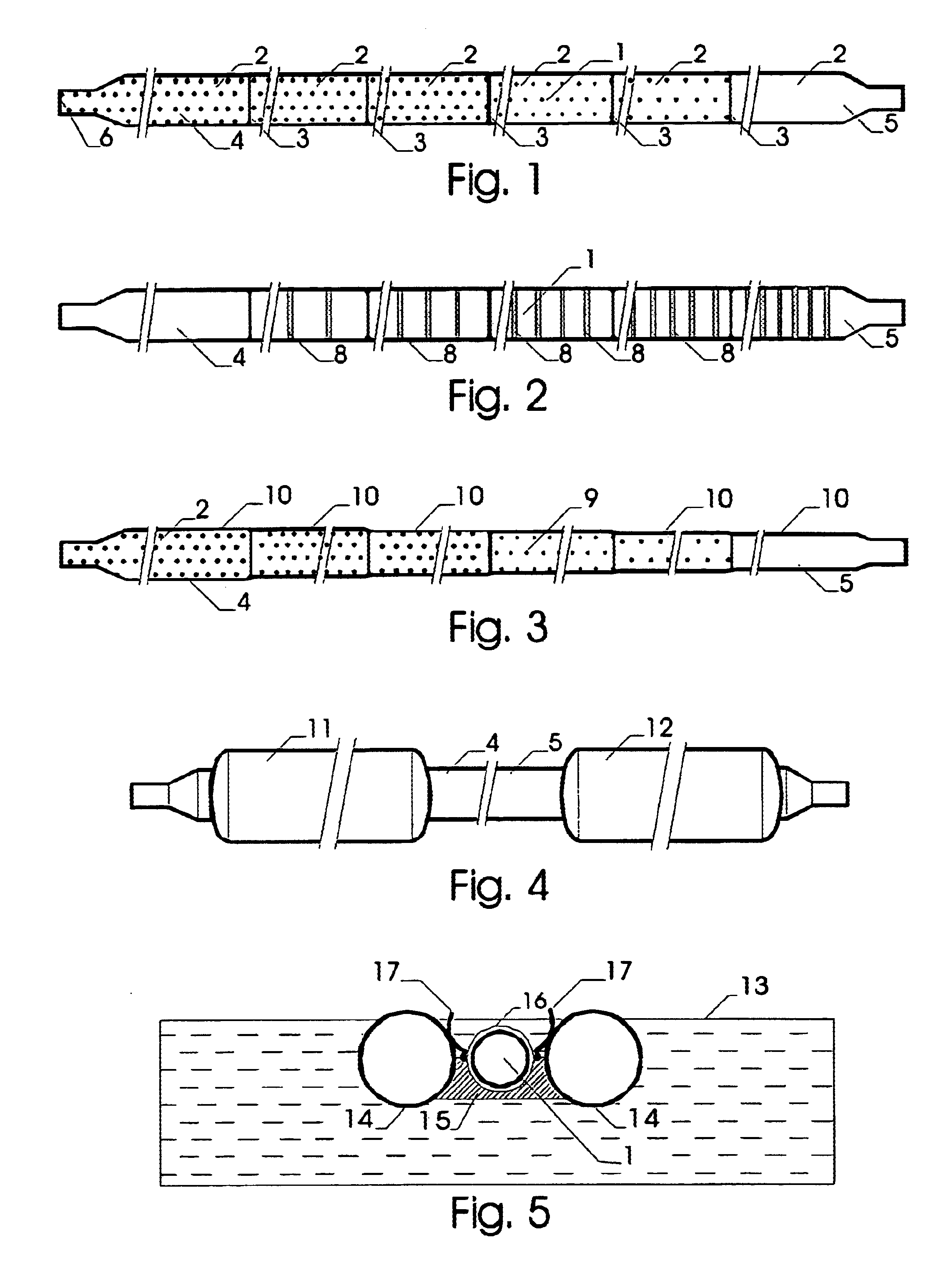 Tension leg and method for transport, installation and removal of tension legs pipelines and slender bodies