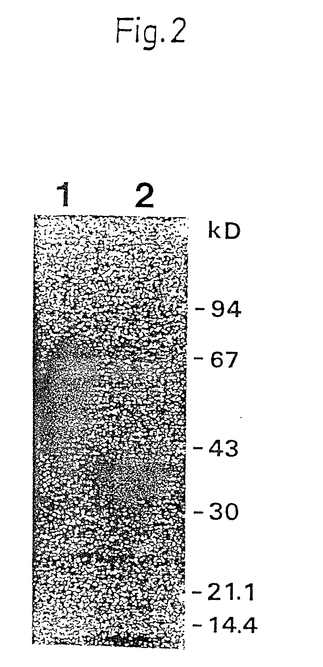 Urokinase-type plasminogen activator receptor