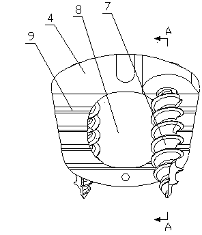 Cervical vertebra anterior zero incisura intervertebral fusion device