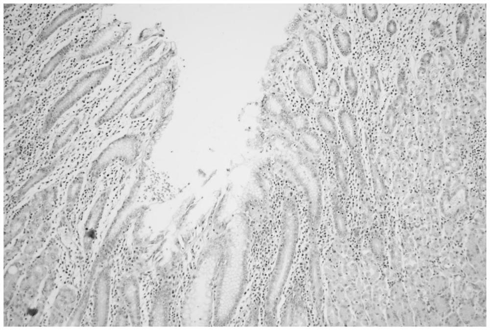 Helicobacter pylori staining kit and application