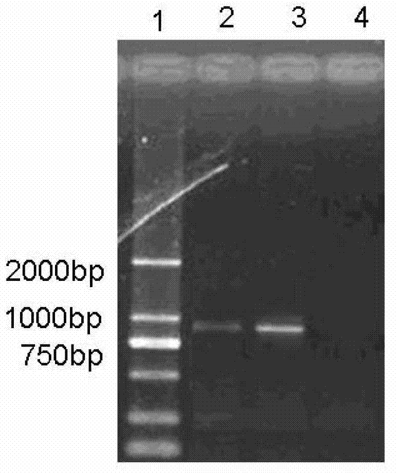 Novel mycoplasma hyopneumoniae bacterial strain and vaccine composition thereof