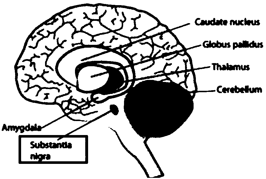 Localization method of non-human primate substantia nigra area