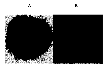 Lactobacillus crispatus and application thereof