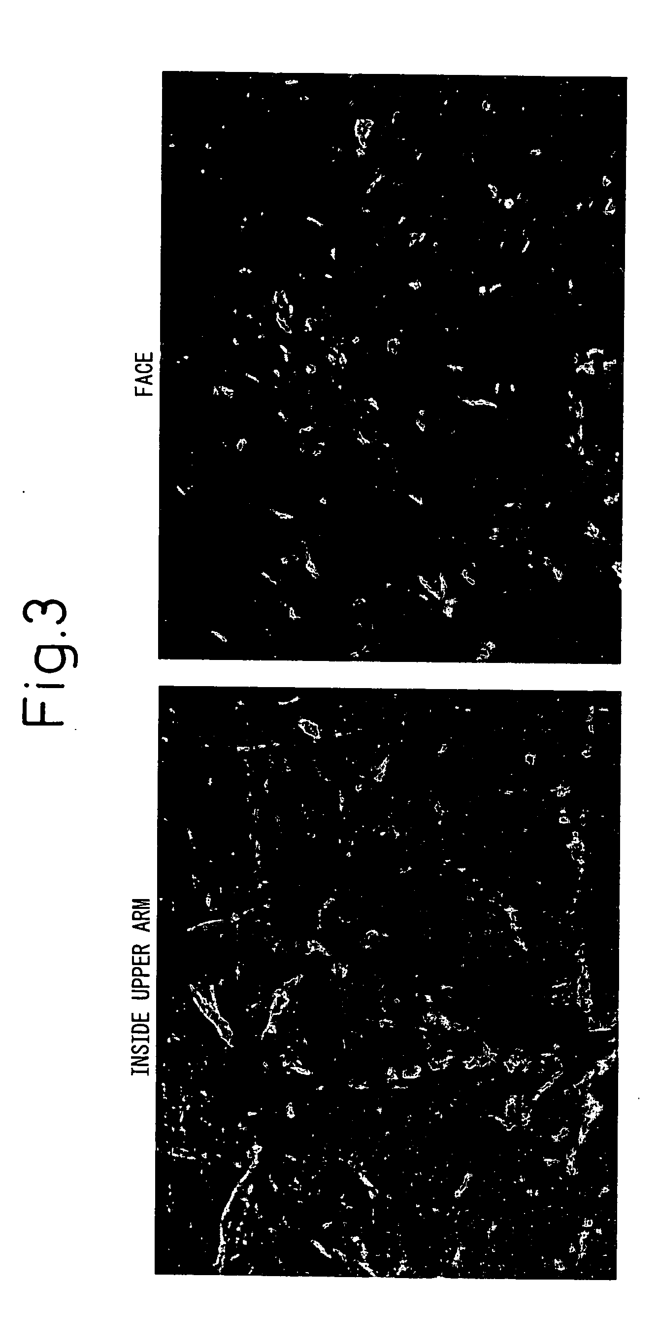 Method for evaluating oxidized protein in horny cell layer