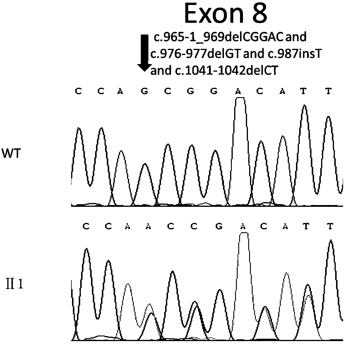 New mutation-causing gene slc12a3 in gitelman syndrome, its encoded protein and its application