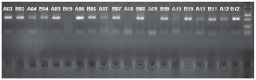 Detection primer for methylation of MT2 (melatonin receptor 2) gene promoter region and detection method and application