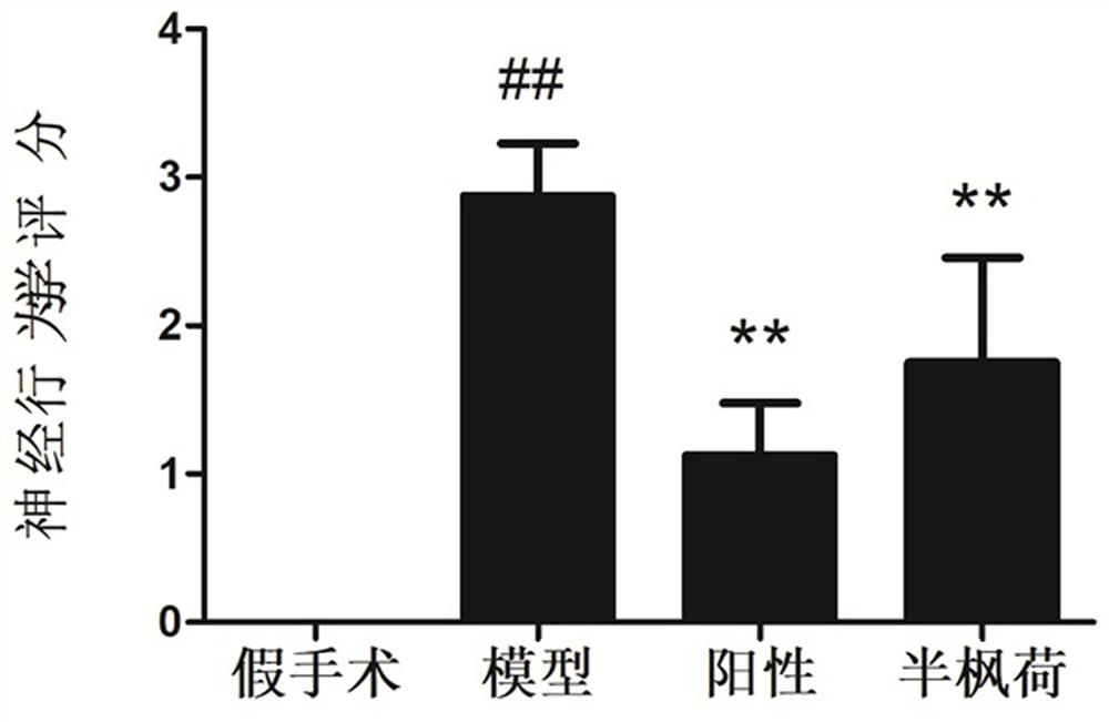 Application of semiliquidambar cathayensis or semiliquidambar cathayensis extract in preparation of anti-cerebral ischemia drugs