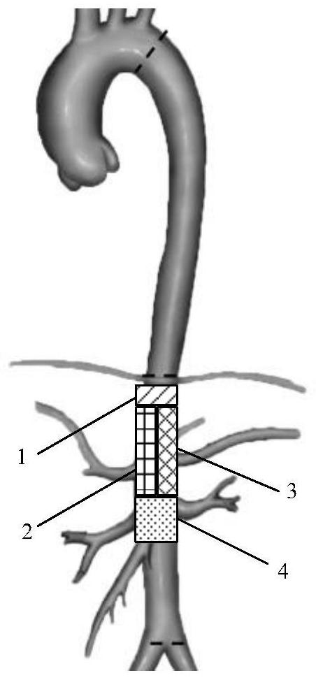 Pharmaceutical application of composition for treating atherosclerosis