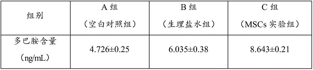 Mesenchymal stem cell injection as well as preparation method and application thereof