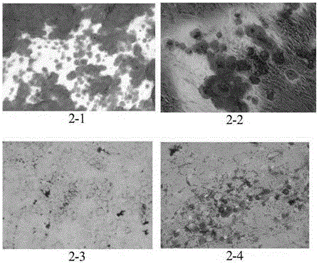 Mesenchymal stem cell injection as well as preparation method and application thereof