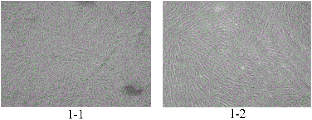 Mesenchymal stem cell injection as well as preparation method and application thereof