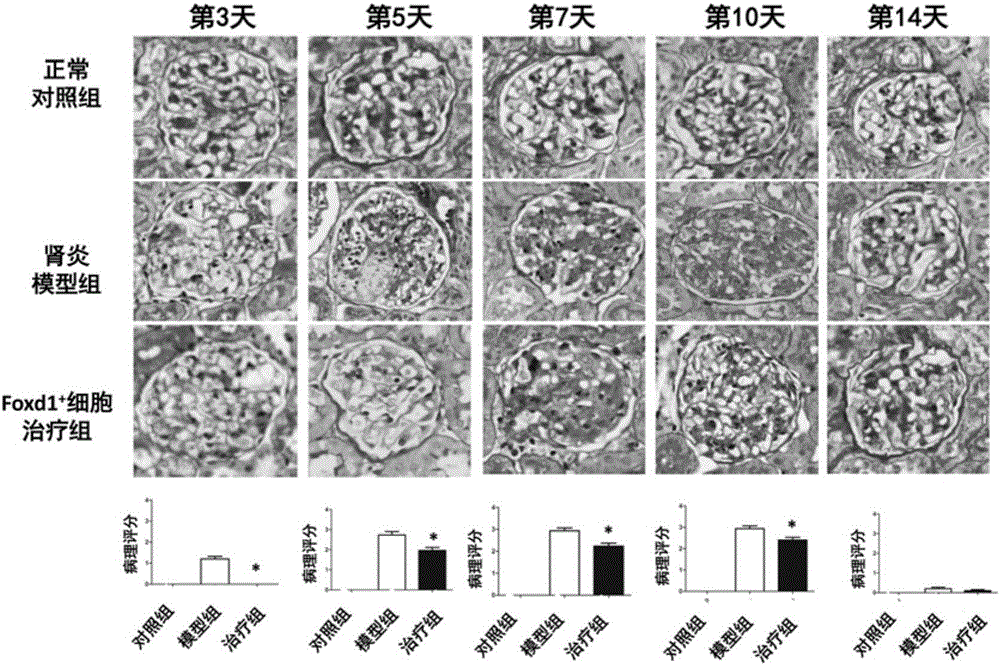 Medicine for treating mesangial proliferative glomerulonephritis