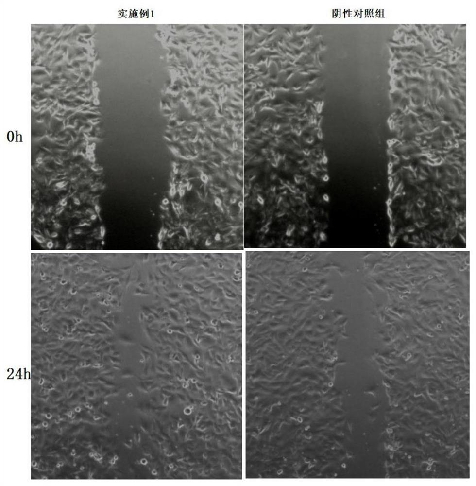 Acne removing repairing cosmetic preparation and preparation method therefor