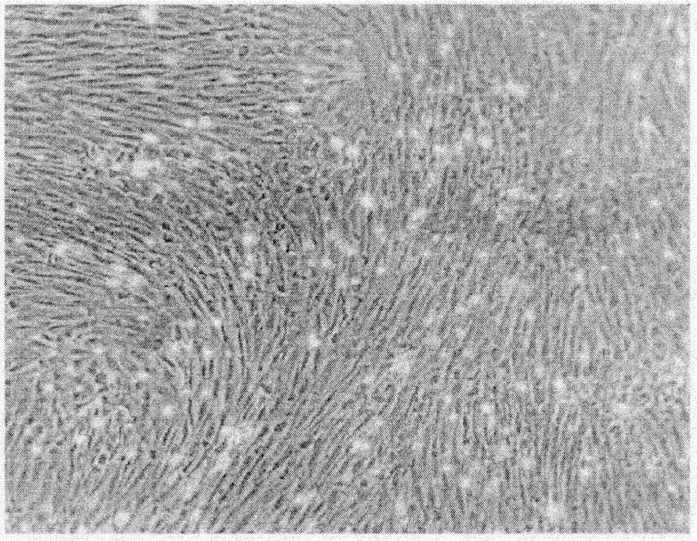 Preparation method of stem cell preparation for repairing diabetes pancreas islet function