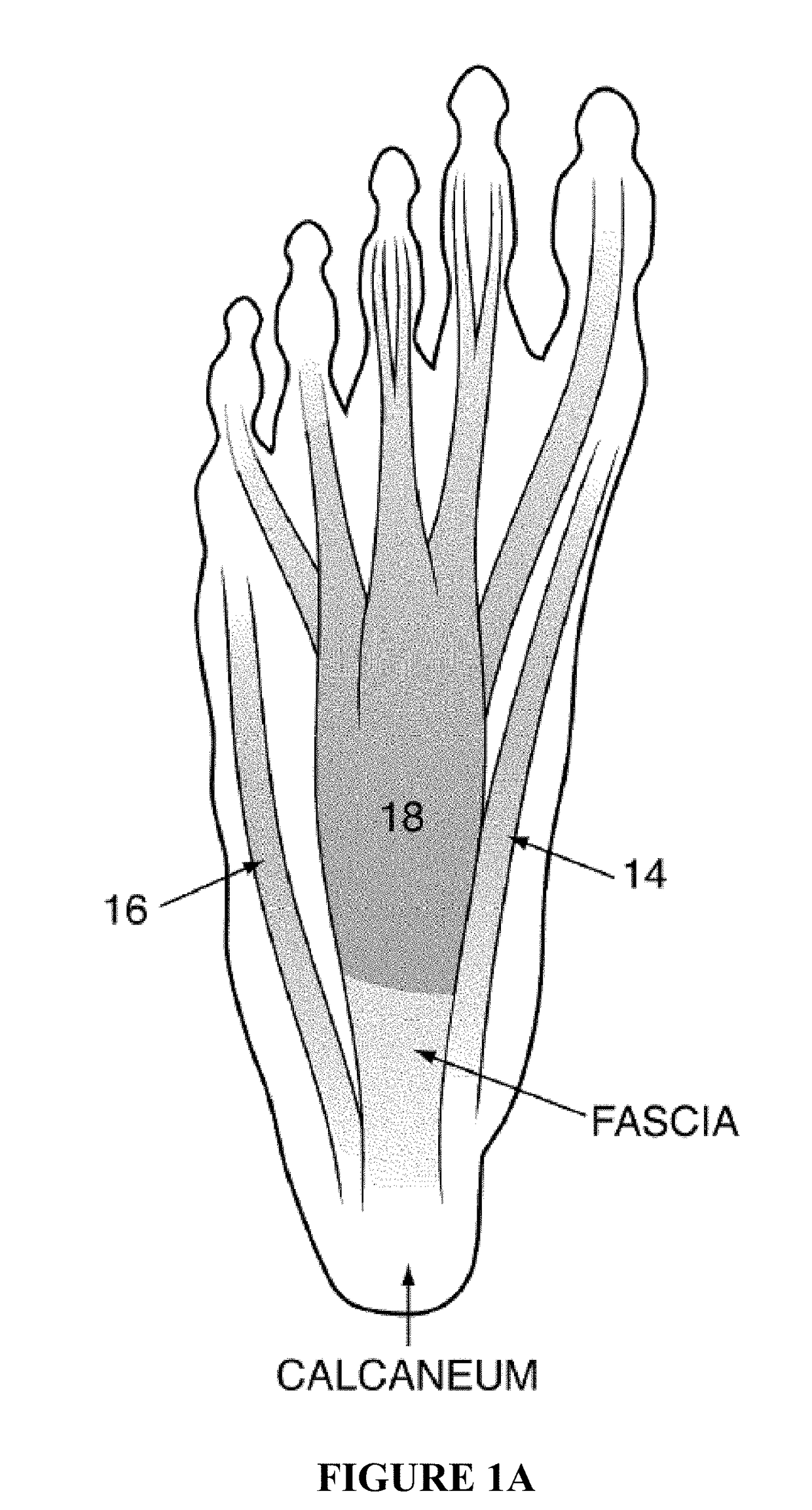 Method and apparatus for noninvasive inhibition of deep vein thrombosis