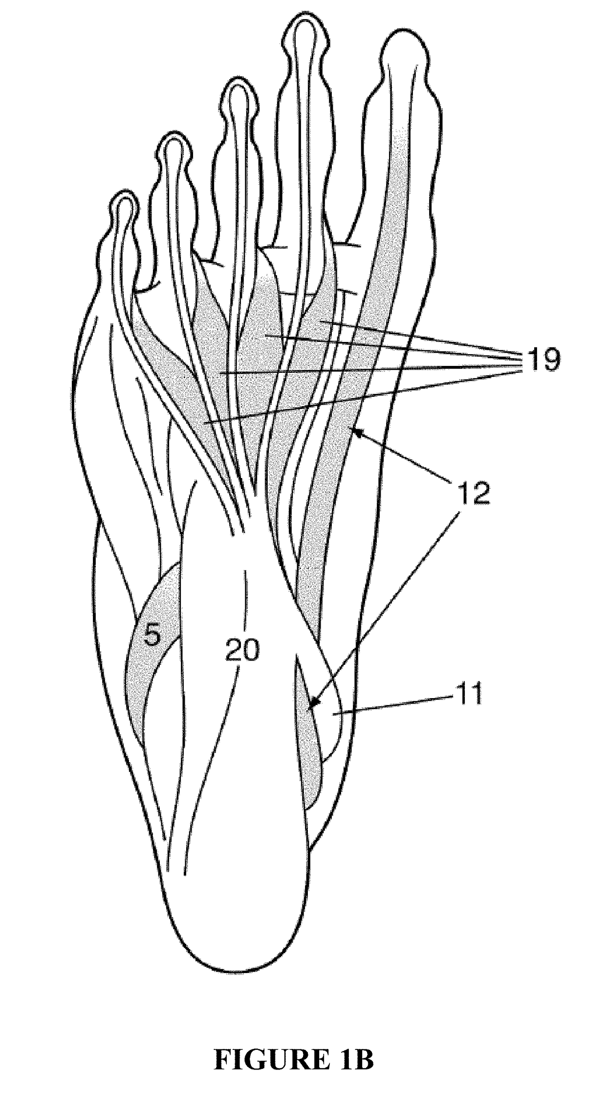 Method and apparatus for noninvasive inhibition of deep vein thrombosis