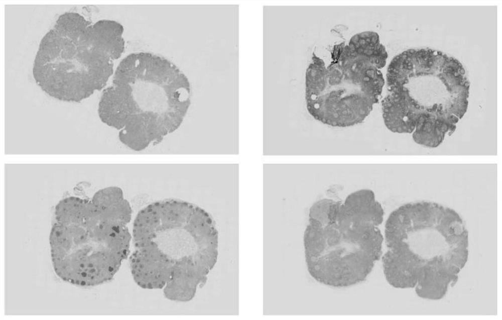 An immunohistochemical digital slide reading system and method