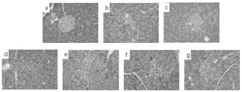 Application of euscaphis konishii hayata extract in preparation of diabetes drugs