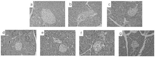 Application of euscaphis konishii hayata extract in preparation of diabetes drugs