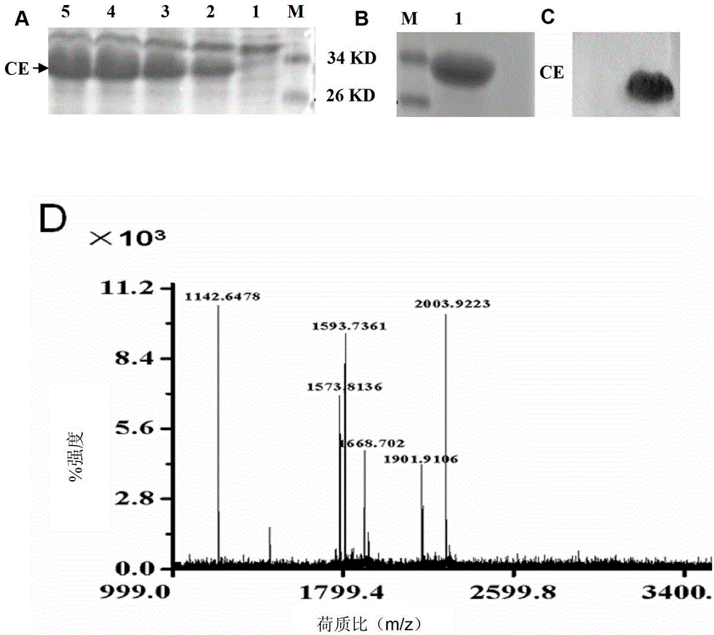 Nucleic acid aptamer capable of being specifically bound to tubercle bacillus antigen and application thereof