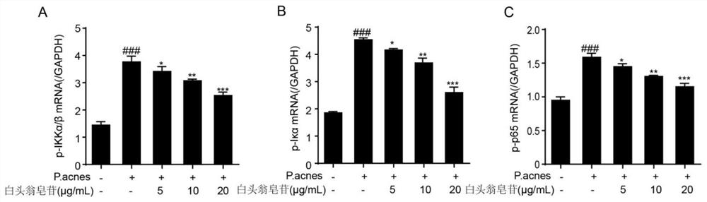 Anti-inflammatory and acne-removing composition and cosmetic