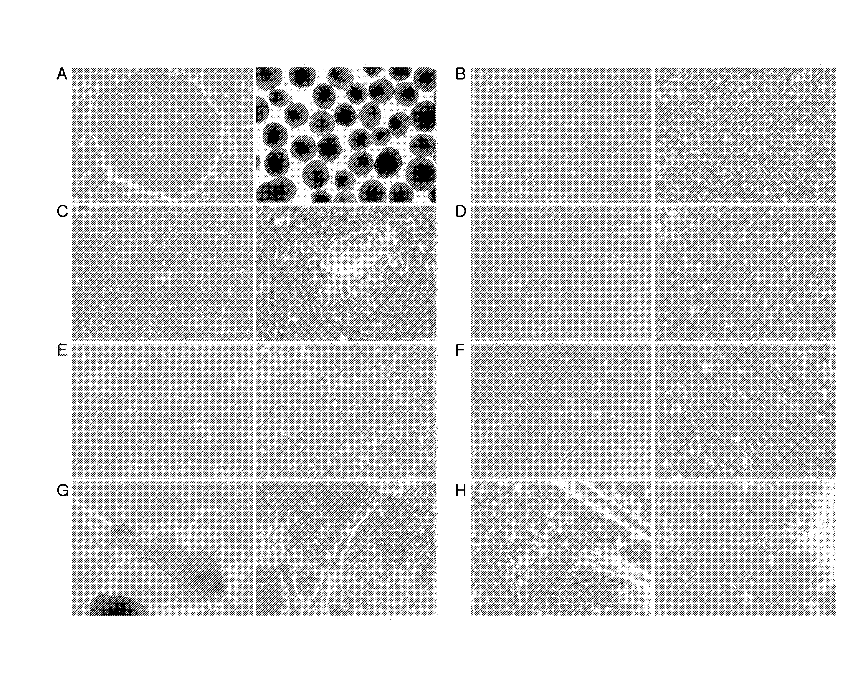 Method for differentiation into retinal cells from stem cells