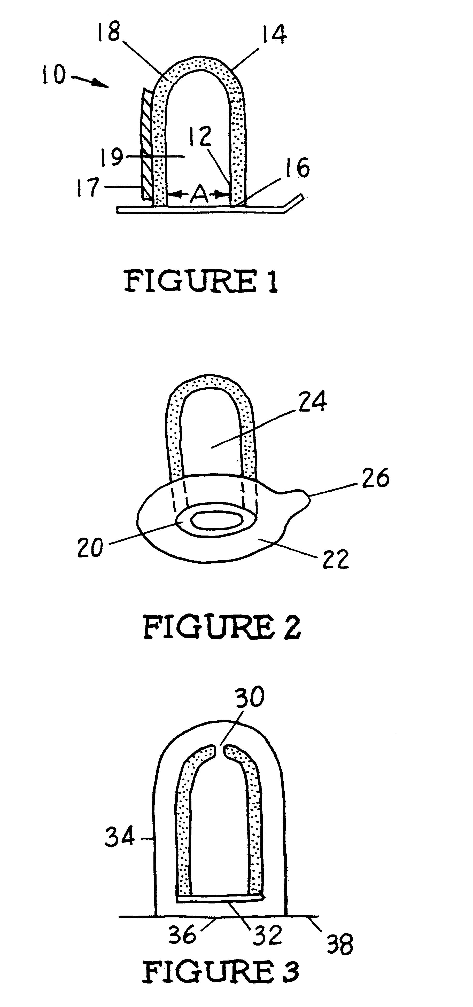 Thermal compress for appendage and method of treating appendage with thermal compress