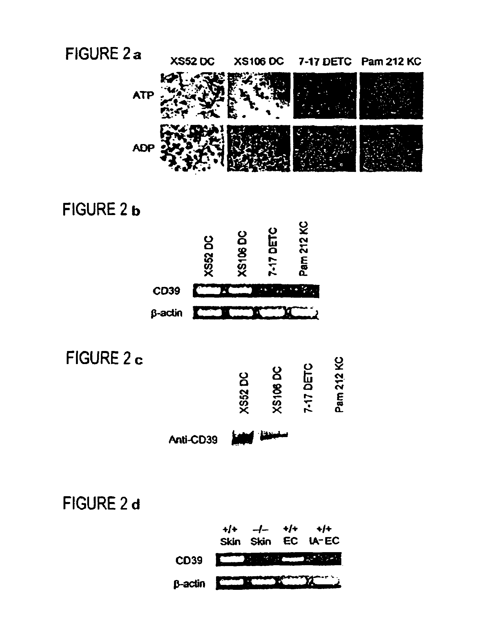 Diagnosis and treatment of inflammation and hyperactive immune conditions