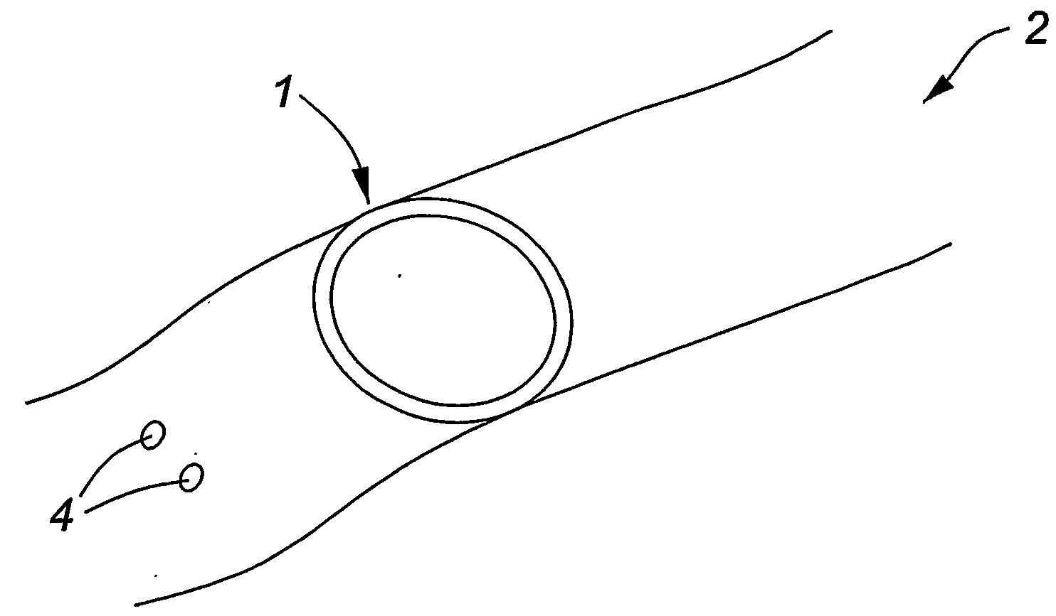 Device and method for attaracting diseased cells and foreign substances