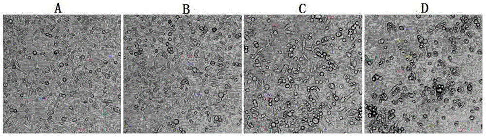 Ruthenium complex as well as preparation method and use thereof