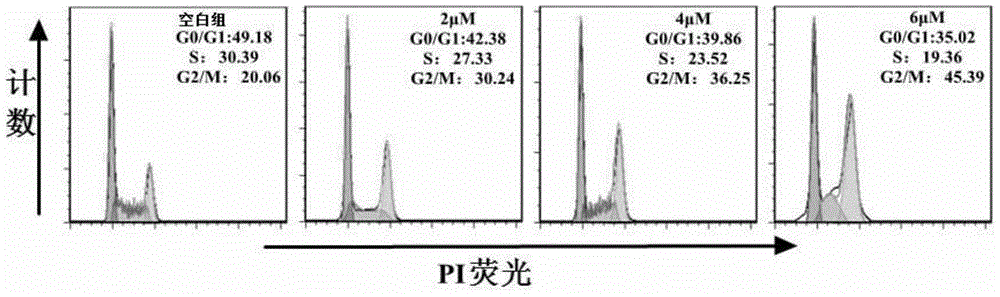 Ruthenium complex as well as preparation method and use thereof