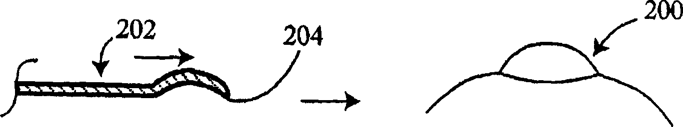 Epithelial pocket expanding tool and combination epithelial delaminating device and corneal reformer