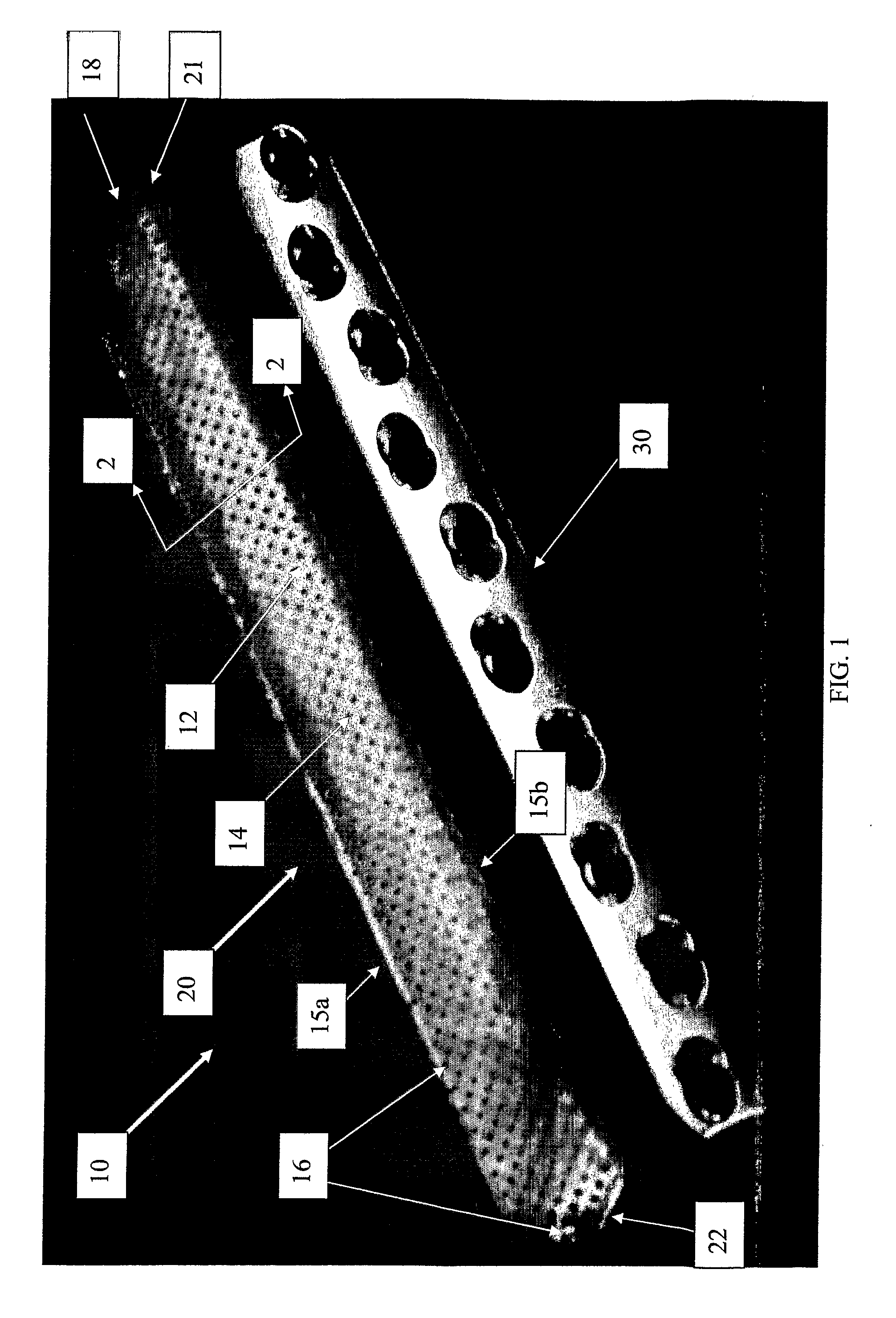 Drug-Impregnated Encasement