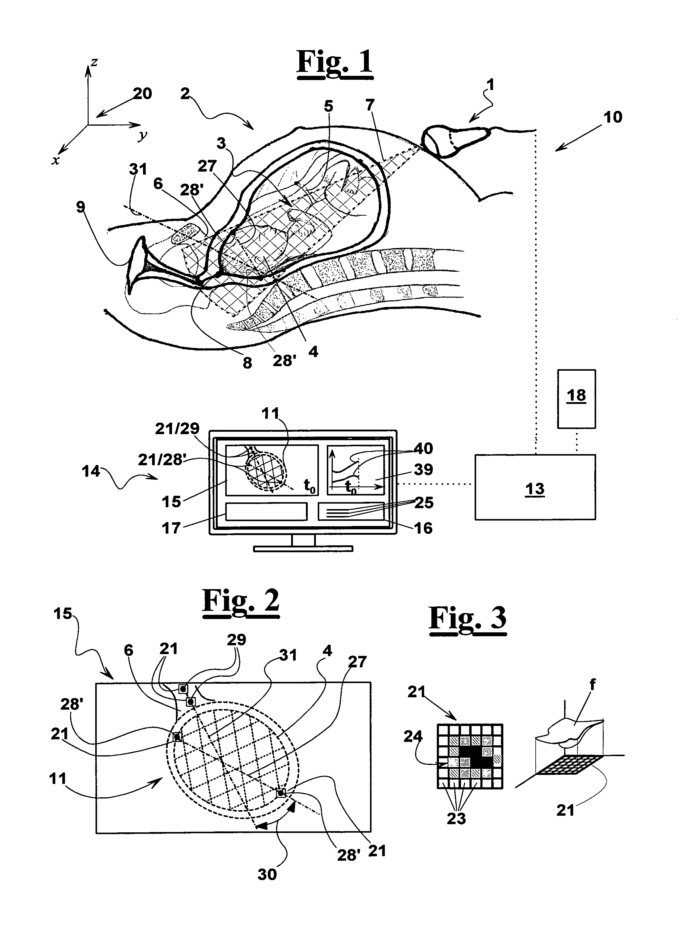 Ultrasonic apparatus for measuring a labor progress parameter