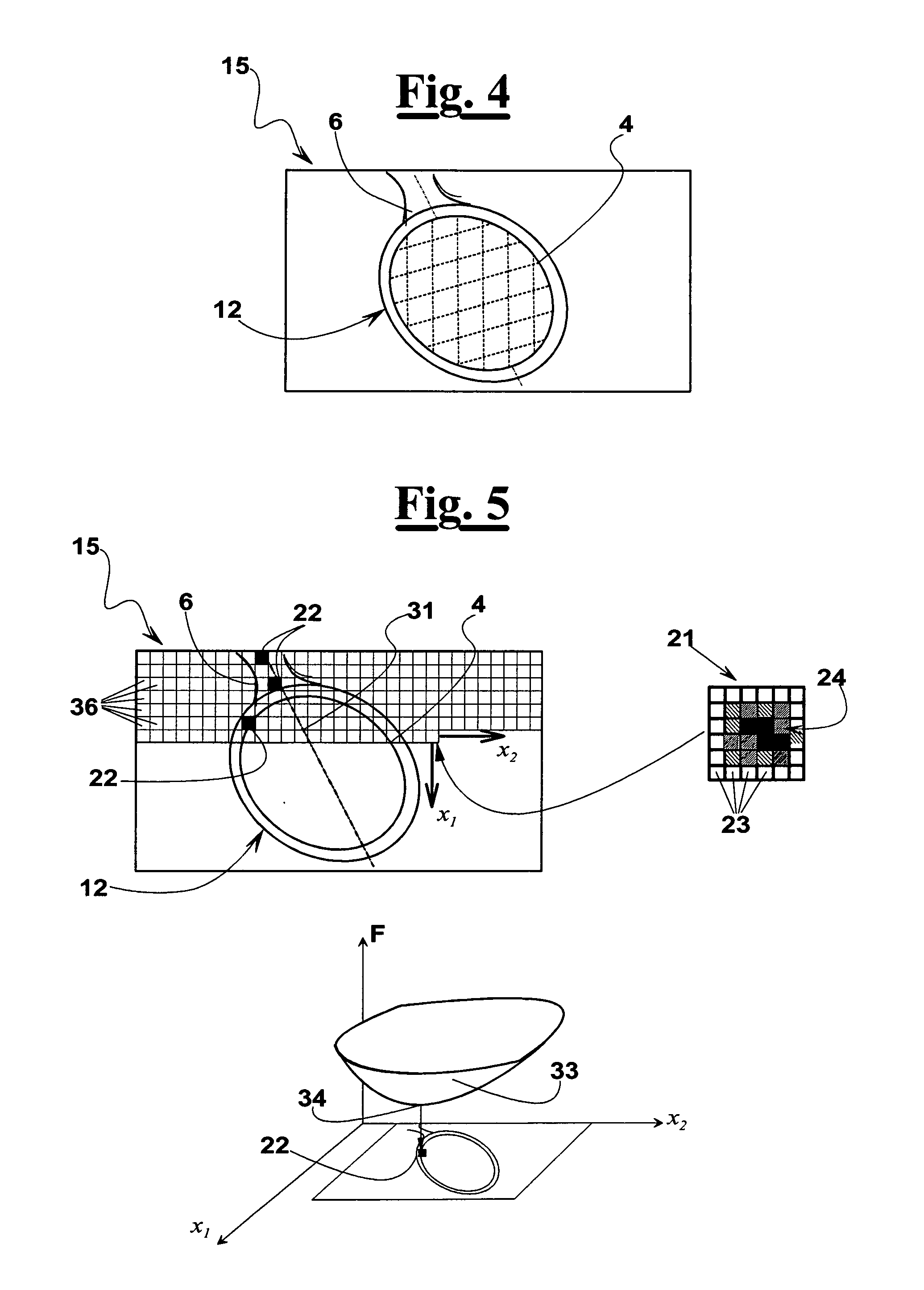 Ultrasonic apparatus for measuring a labor progress parameter