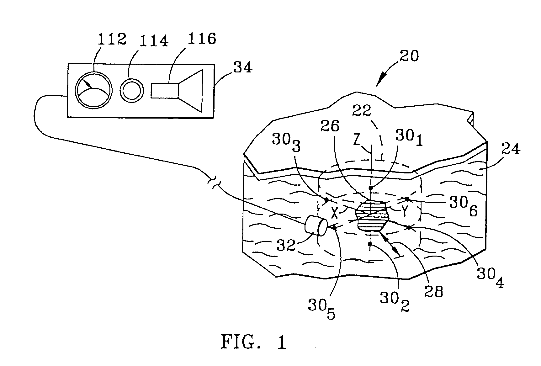 System and Method for Bracketing and Removing Tissue