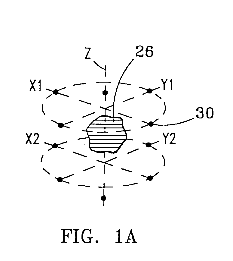 System and Method for Bracketing and Removing Tissue