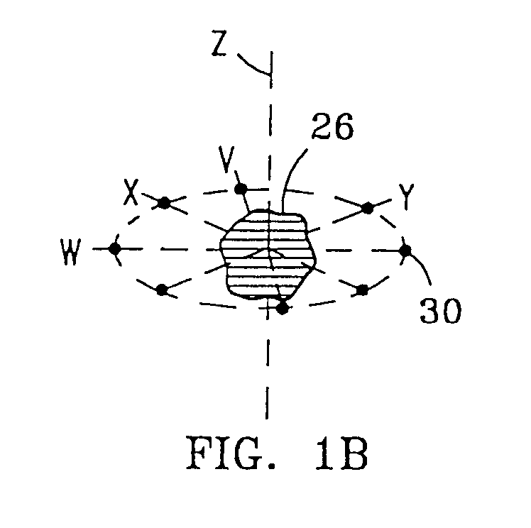 System and Method for Bracketing and Removing Tissue