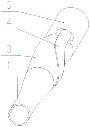 Totally closed bionic upper arm prosthesis