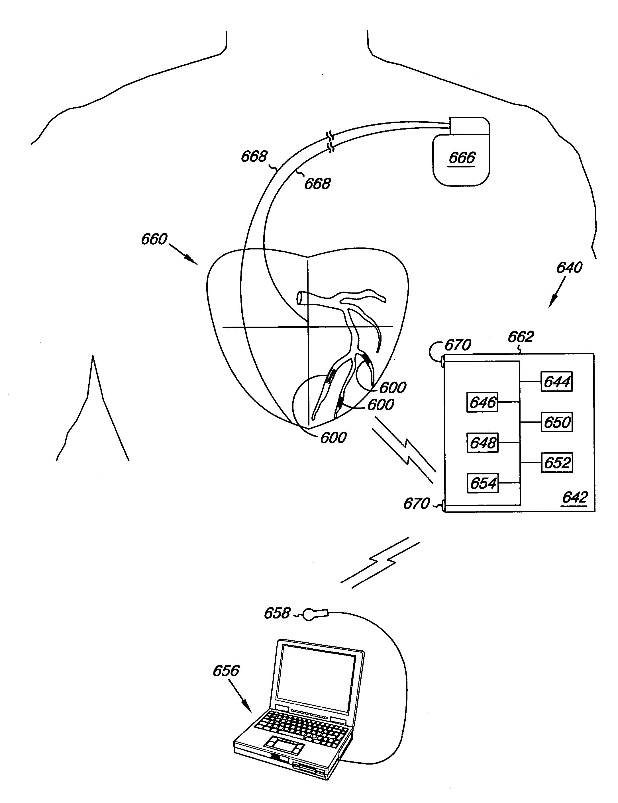 Electrode apparatus, systems and methods