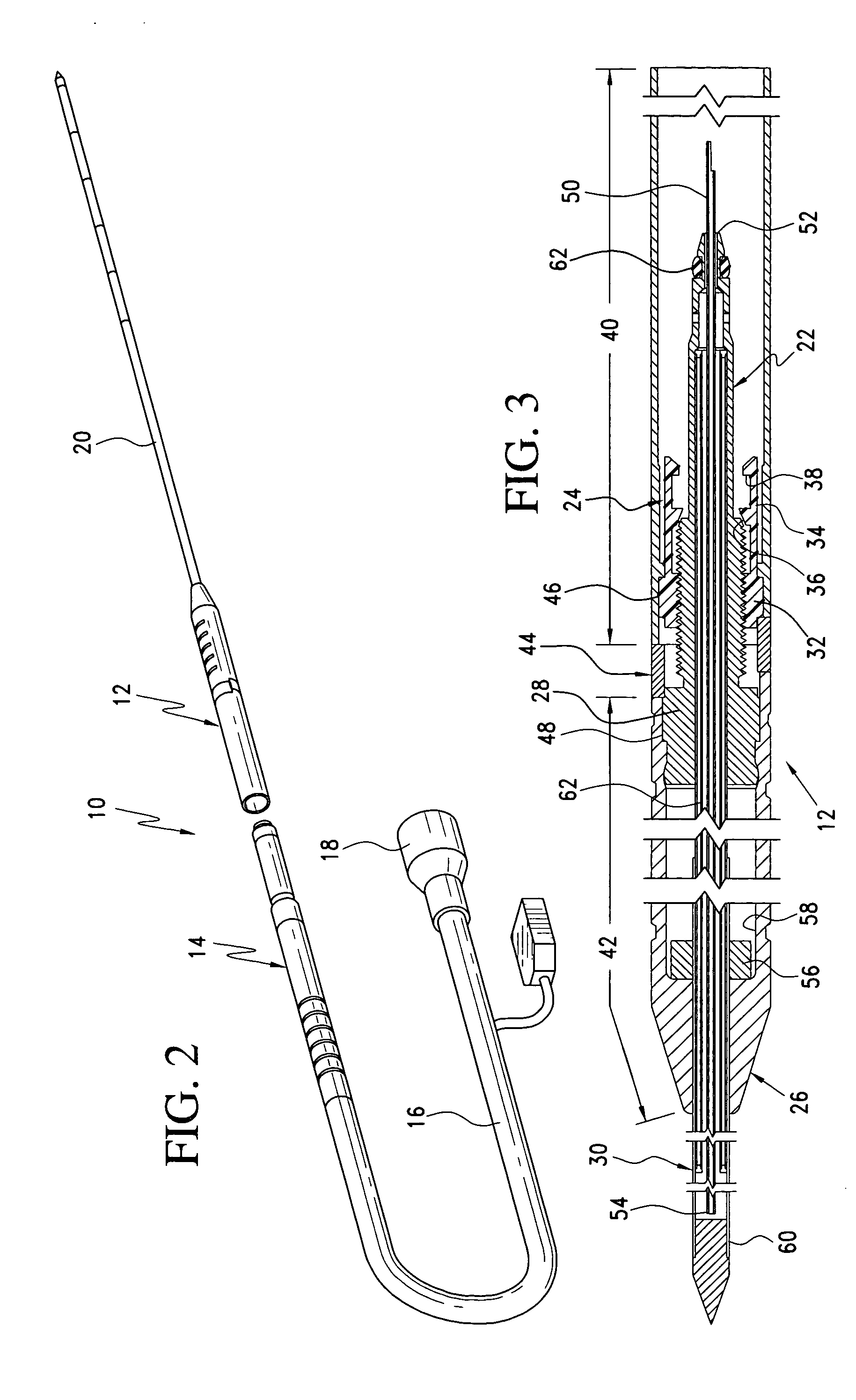 Detachable cryosurgical probe with breakaway handle