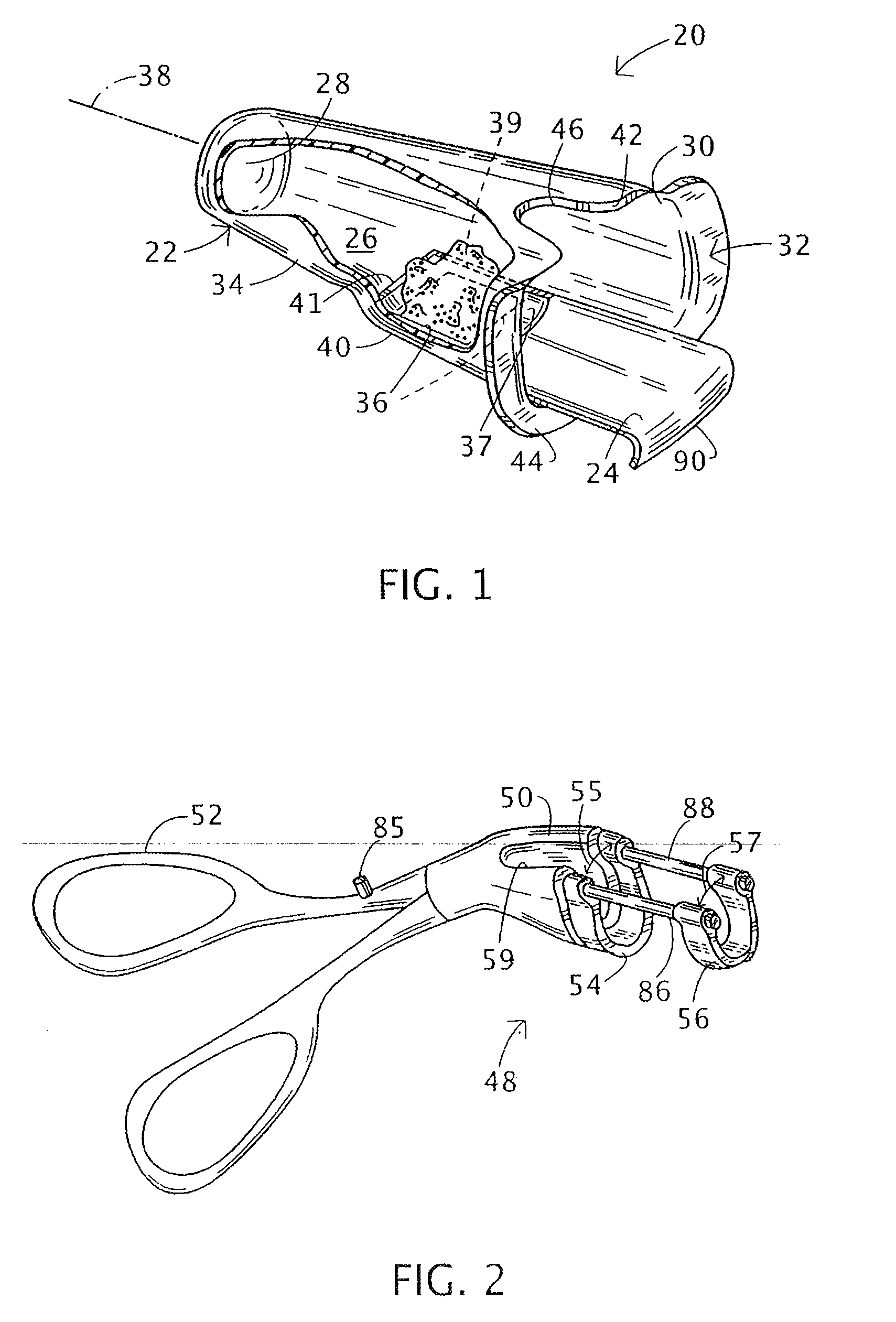 Endoluminal treatment method and associated surgical assembly including tissue occlusion device