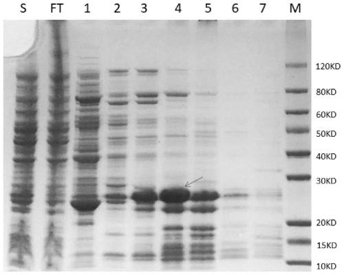 Mycoplasma pneumoniae fusion antigen as well as preparation method and application thereof