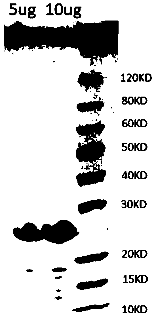 Mycoplasma pneumoniae fusion antigen as well as preparation method and application thereof