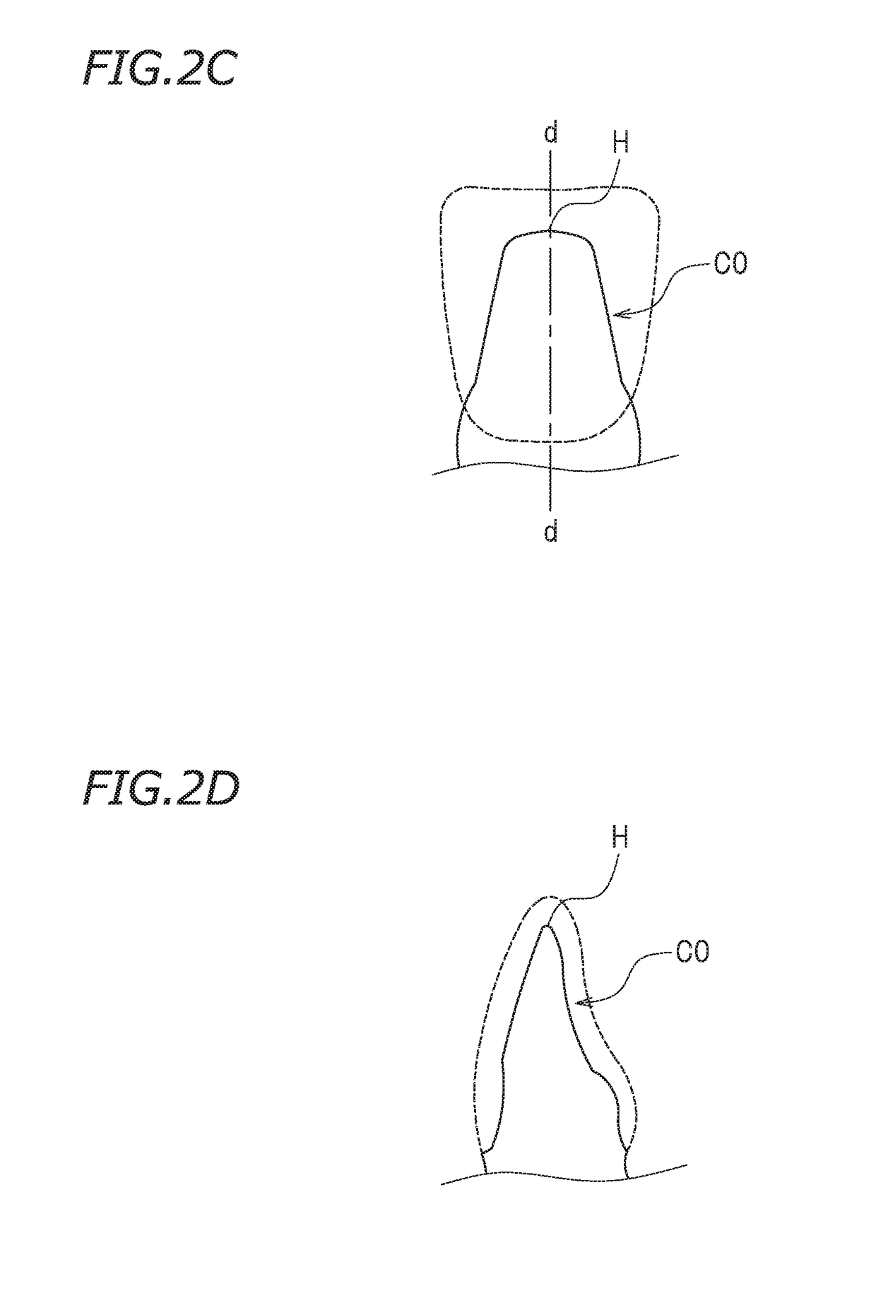 Crown prosthesis preparing system, crown prosthesis preparing method, and non-transitory storage medium storing program for preparing crown prosthesis