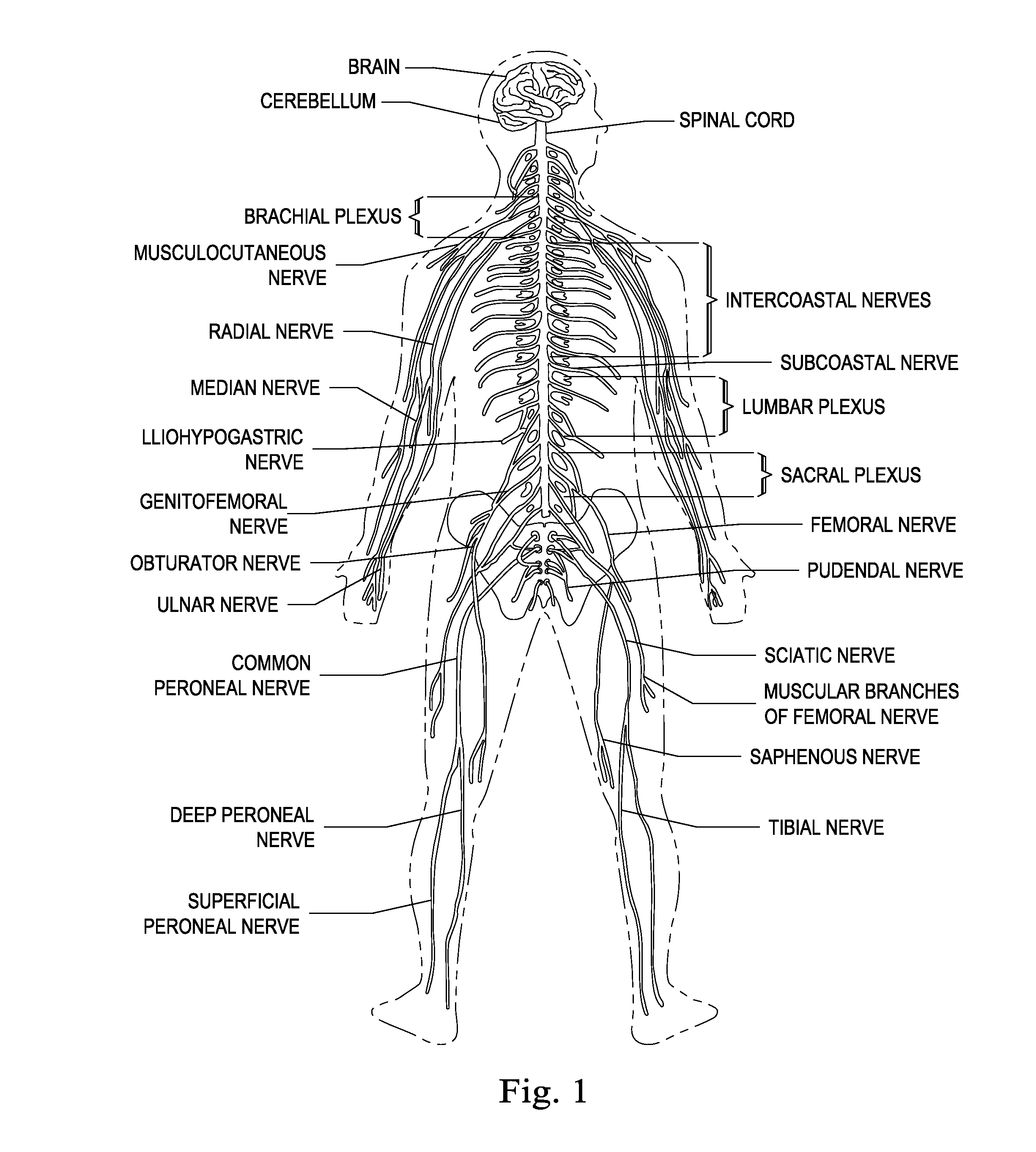 Ipg configured to deliver different pulse regimes to different leads for pudendal nerve stimulation