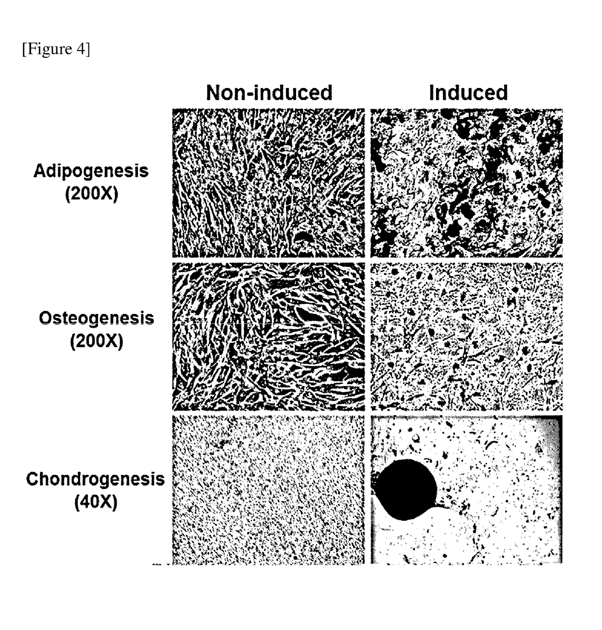 Mesenchymal stem cell expressing trail and cd, and use thereof