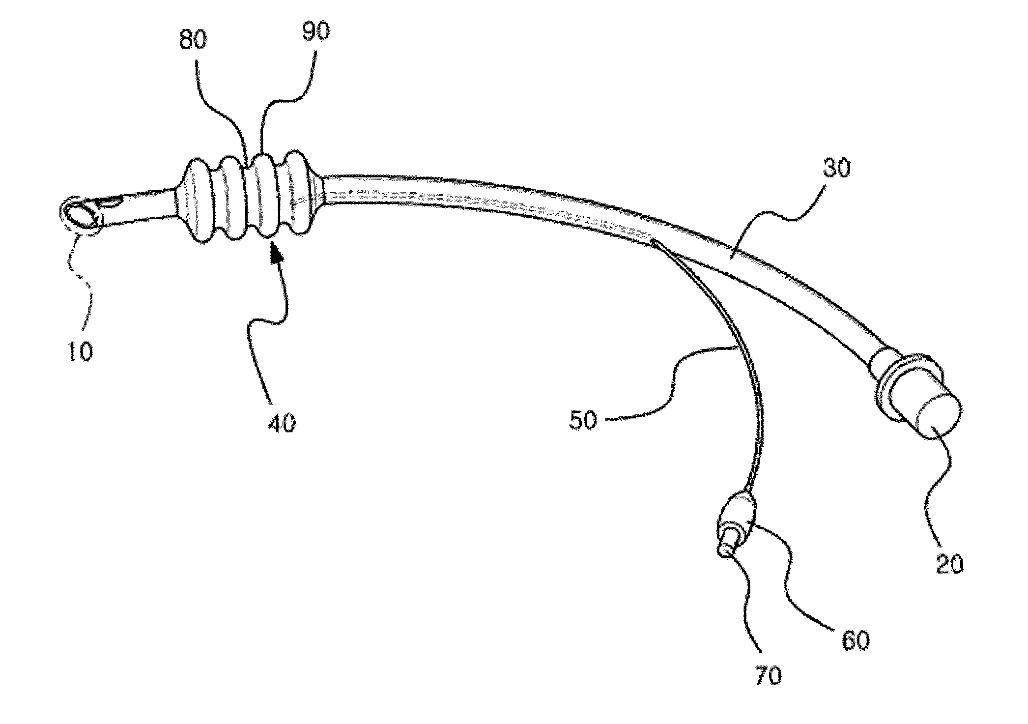 Endotracheal tube comprising corrugated cuff