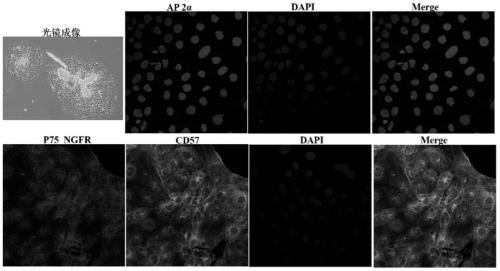 Method for Directed Induction and Differentiation of Human Embryonic Stem Cells into Corneal Endothelial Cells